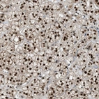 Immunohistochemical staining of human adrenal gland shows moderate to strong nuclear positivity in glandular cells.