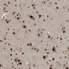 Immunohistochemical staining of human cerebral cortex shows moderate to strong nuclear and cytoplasmic positivity in neurons.