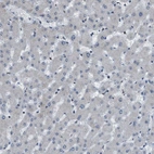 Immunohistochemical staining of human liver shows no positivity as expected.