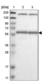 Lane 1: Marker [kDa] 230, 130, 95, 72, 56, 36, 28, 17, 11_br/_Lane 2: Human cell line RT-4_br/_Lane 3: Human cell line U-251MG sp