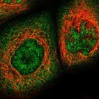 Immunofluorescent staining of human cell line A-431 shows localization to nucleoplasm & cytosol.