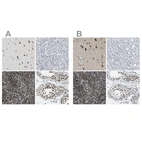 Immunohistochemical staining of human cerebral cortex, liver, lymphoid tissues and testis using Anti-FOXK1 antibody HPA018864 (A) shows similar protein distribution across tissues to independent antibody HPA017998 (B).