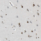 Immunohistochemical staining of human cerebral cortex shows moderate to strong nuclear positivity in neurons.