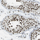 Immunohistochemical staining of human testis shows moderate to strong nuclear positivity in cells in seminiferous ducts.