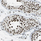 Immunohistochemical staining of human testis shows moderate to strong nuclear positivity in cells in seminiferous ducts.