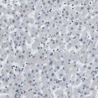 Immunohistochemical staining of human liver shows no positivity in hepatocytes as expected.