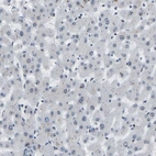 Immunohistochemical staining of human liver shows no positivity in hepatocytes as expected.