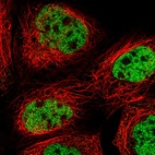 Immunofluorescent staining of human cell line A-431 shows localization to nucleoplasm.