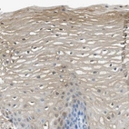 Immunohistochemical staining of human esophagus shows high expression.