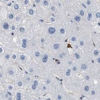Immunohistochemical staining of human liver using Anti-SERPINB1 antibody HPA018871.