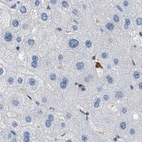 Immunohistochemical staining of human liver using Anti-SERPINB1 antibody HPA018871.