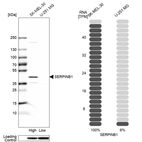 Western blot analysis in human cell lines SK-MEL-30 and U-251MG using Anti-SERPINB1 antibody. Corresponding SERPINB1 RNA-seq data are presented for the same cell lines. Loading control: Anti-HDAC1.