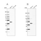 Western blot analysis using Anti-SERPINB1 antibody HPA018871 (A) shows similar pattern to independent antibody HPA052642 (B).