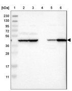 Lane 1: Marker [kDa] 230, 130, 95, 72, 56, 36, 28, 17, 11_br/_Lane 2: Human cell line RT-4_br/_Lane 3: Human cell line U-251MG sp_br/_Lane 4: Human plasma (IgG/HSA depleted)_br/_Lane 5: Human liver tissue_br/_Lane 6: Human tonsil tissue