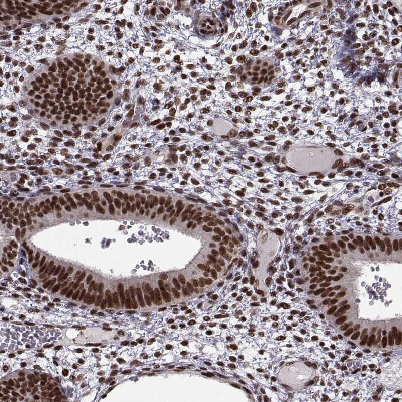 Rabbit Polyclonal Anti-SF1 Antibody - Buy for research - Highly ...