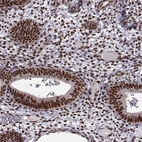 Immunohistochemical staining of human endometrium shows moderate to strong nuclear positivity in glandular cells.