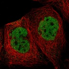 Immunofluorescent staining of human cell line A-431 shows localization to nucleoplasm.