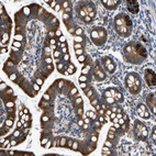 Immunohistochemical staining of human small intestine shows strong cytoplasmic positivity in glandular cells.