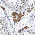 Immunohistochemical staining of human testis shows moderate cytoplasmic positivity in Leydig cells.