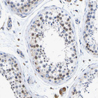 Immunohistochemical staining of human testis shows no cytoplasmic positivity in cells in seminiferous ducts as expected.