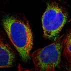 Immunofluorescent staining of human cell line U-2 OS shows localization to endoplasmic reticulum.