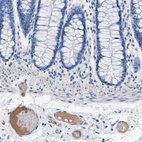 Anti-APOL1 Antibody