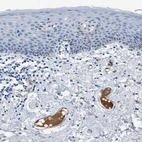 Immunohistochemical staining of human skin shows strong positivity in plasma in blood vessels.