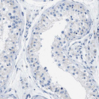 Anti-APOL1 Antibody