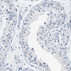 Immunohistochemical staining of human testis shows negative cytoplasmic positivity in cells in seminiferous ducts as expected.