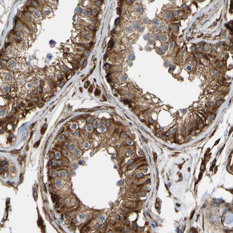 Anti-BEX3 Antibody