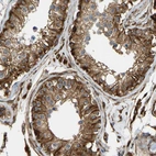 Anti-BEX3 Antibody