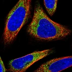 Immunofluorescent staining of human cell line U-2 OS shows localization to cytosol.
