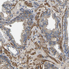Immunohistochemical staining of human prostate shows moderate cytoplasmic and membranous positivity in glandular cells and smooth muscle cells.