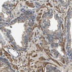 Immunohistochemical staining of human prostate shows moderate cytoplasmic and membranous positivity in glandular cells and smooth muscle cells.