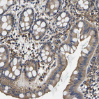 Immunohistochemical staining of human rectum shows moderate cytoplasmic positivity in glandular cells.