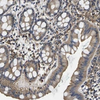 Immunohistochemical staining of human rectum shows moderate cytoplasmic positivity in glandular cells.
