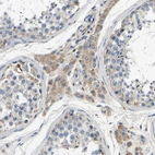 Immunohistochemical staining of human testis shows moderate cytoplasmic positivity in Leydig cells.