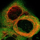 Immunofluorescent staining of human cell line A-431 shows positivity in plasma membrane & cytoplasm.