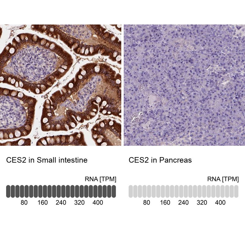 Anti-CES2 Antibody