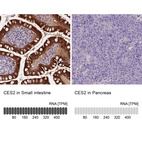 Anti-CES2 Antibody