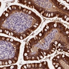 Immunohistochemical staining of human small intestine shows high expression.