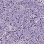 Immunohistochemical staining of human pancreas shows low expression as expected.