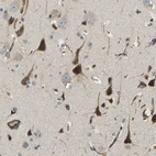 Immunohistochemical staining of human cerebral cortex shows moderate to strong cytoplasmic positivity in neurons.