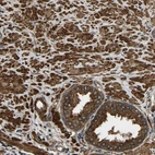 Immunohistochemical staining of human prostate shows strong cytoplasmic positivity in smooth muscle cells and glandular cells.