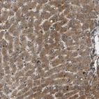 Immunohistochemical staining of human liver shows strong cytoplasmic positivity in hepatocytes.