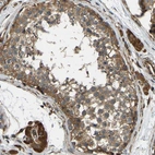 Immunohistochemical staining of human testis shows moderate to strong cytoplasmic positivity in cells in seminiferous ducts.