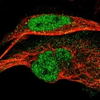 Immunofluorescent staining of human cell line U-2 OS shows localization to nucleoplasm & vesicles.