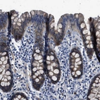 Immunohistochemical staining of human colon shows moderate to strong cytoplasmic positivity in glandular cells.