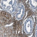 Immunohistochemical staining of human endometrium shows strong membranous positivity in stromal cells.