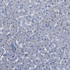 Immunohistochemical staining of human liver shows no positivity in hepatocytes as expected.